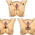 Pourquoi intégrer le massage du périnée pendant le dernier mois de grossesse ? Les avantages expliqués par Naturelle Maman