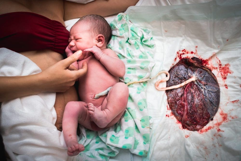 bienfaits clampage tardif cordon