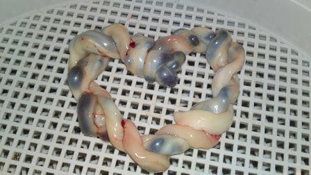 Clampage tardif du cordon : un cadeau de naissance ultra-précieux pour votre bébé