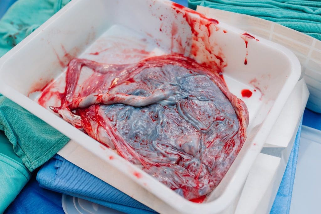 Les 6 pouvoirs étonnants de votre placenta