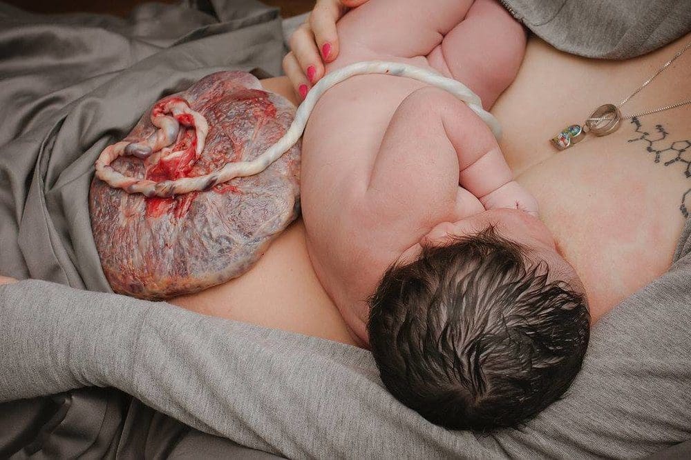 Comment faire de l'isothérapie placentaire et quels sont ses bienfaits sur Naturelle maman