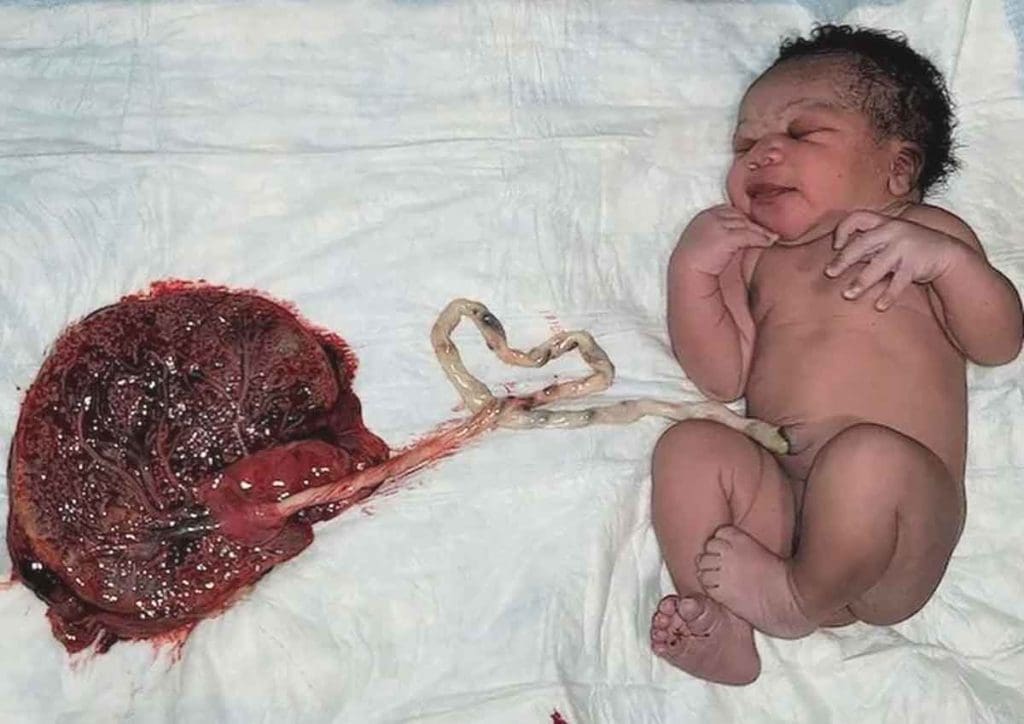 Récit de naissance douce de Marie-Paule "3 bébés, 3 naissances uniques"