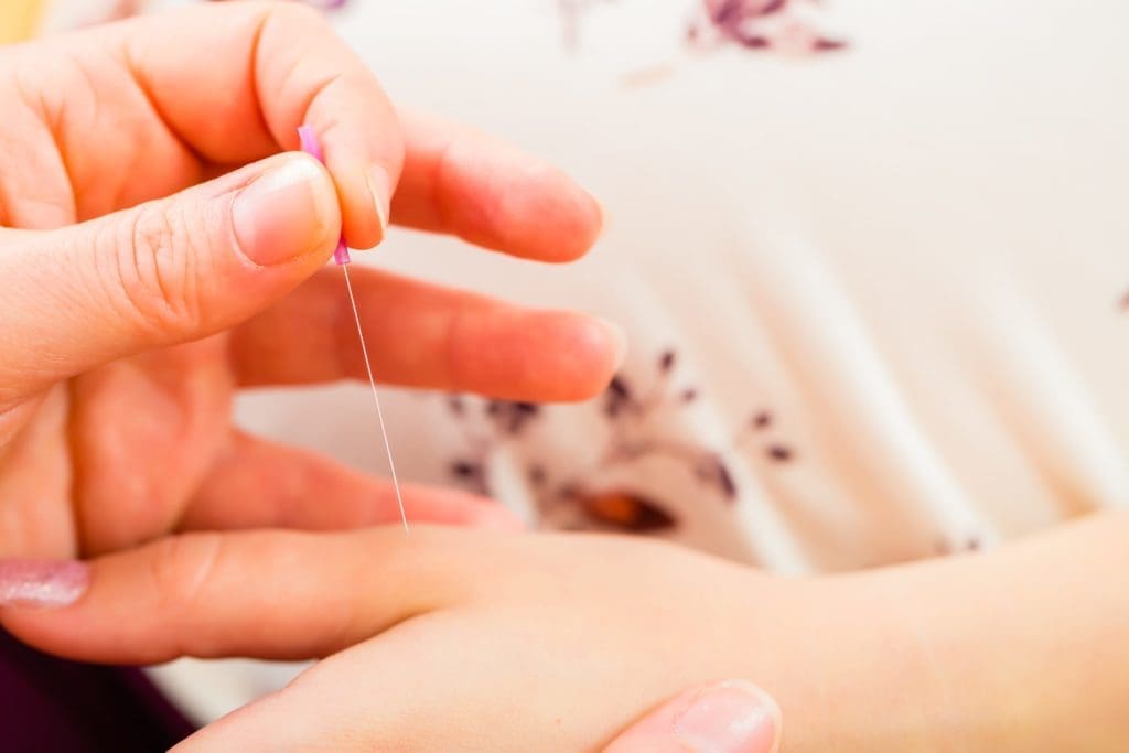 8 bienfaits de l’acupuncture pour préparer votre accouchement