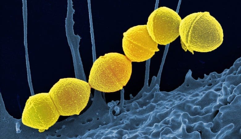 Le docteur Madeleine Matura, gynécologue-obstétricienne, vous conseille les meilleurs remèdes naturels pour soigner un streptocoque B pendant la grossesse sur Naturelle Maman