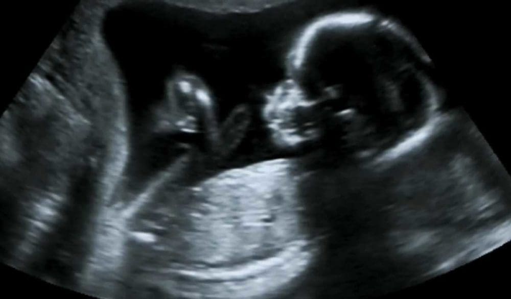 Être déçue en apprenant le sexe de son bébé ne doit pas vous faire culpabiliser. Voici quelques conseils pour surmonter cette épreuve si vous y êtes confrontée.