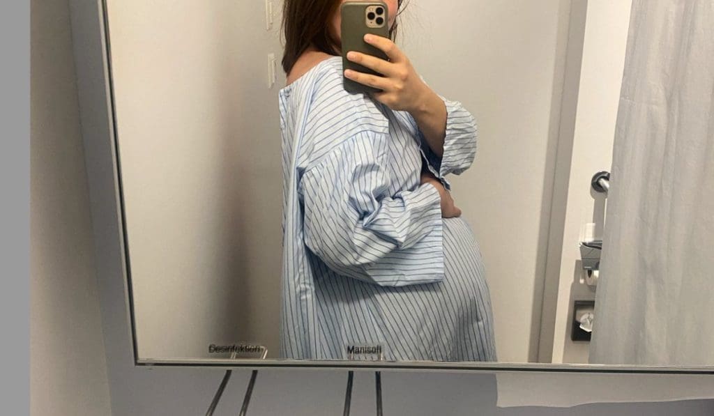 Nouveau récit de naissance douce sur Naturelle Maman : Marie raconte sa césarienne douce. 