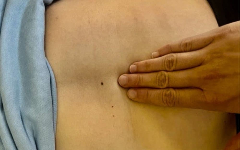 L'expression abdominale pendant l'accouchement est un acte dangereux qui reste malgré tout pratiqué dans certaines maternités - Naturelle Maman
