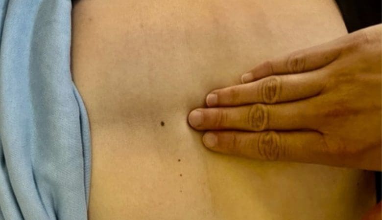 L'expression abdominale pendant l'accouchement est un acte dangereux qui reste malgré tout pratiqué dans certaines maternités - Naturelle Maman